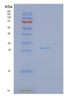 Recombinant Human ITGB3BP Protein