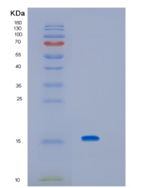 Recombinant Human KCNMB3 Protein