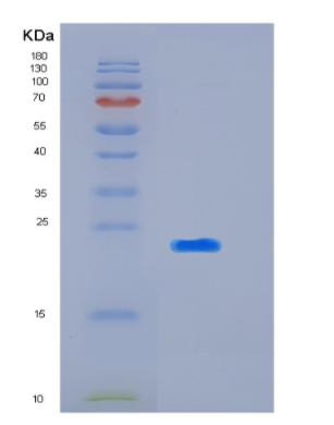 Recombinant Human KIR2DL3(p58 KIR Protein