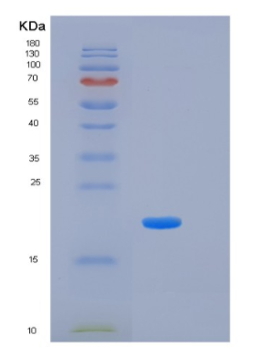 Recombinant Human KLK7 Protein