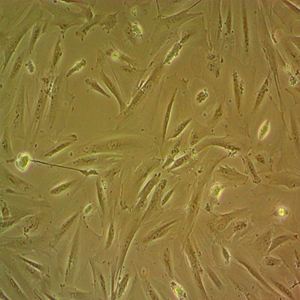 RCM-1人直肠腺癌细胞