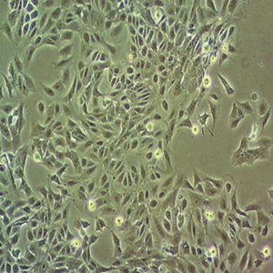 QGY-7703人肝癌细胞