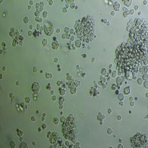 CaES-17人食管癌细胞