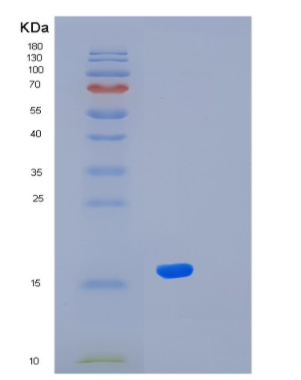 Recombinant Human KLRG1 Protein