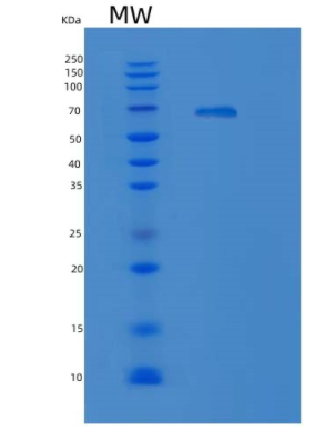 Recombinant Human KRS (Lysyl-tRNA synthetase) Protein