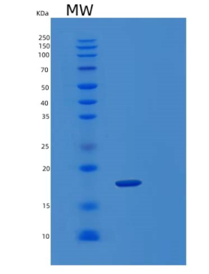 Recombinant Human KLRC2 Protein