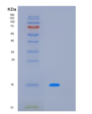 Recombinant Human LAIR2 Protein