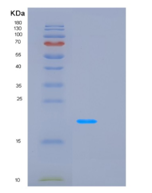 Recombinant Human LCN2 Protein