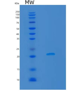 Recombinant Rat Lcn2 Protein