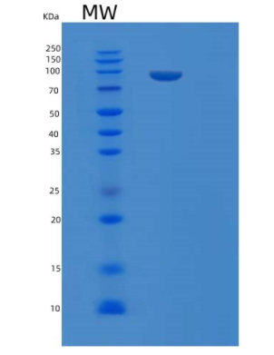 Recombinant Human LIFR Protein