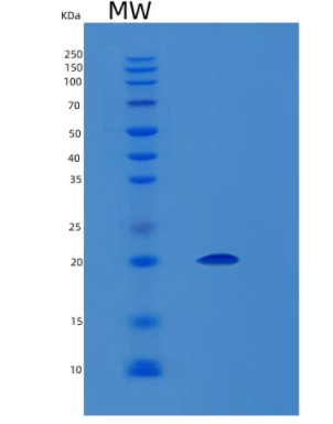 Recombinant Human LGALSL Protein