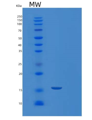 Recombinant Human LIMD2 Protein