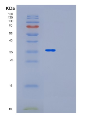 Recombinant Human LRG1 Protein