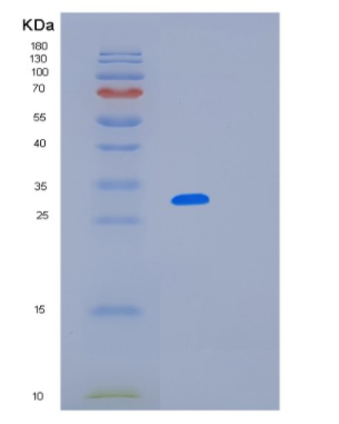 Recombinant Human LRRC59 Protein