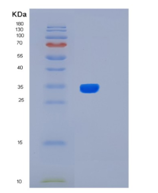 Recombinant Human Livin beta Protein