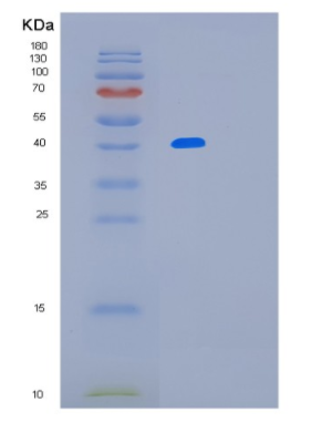 Recombinant Mouse Lrpap1 Protein