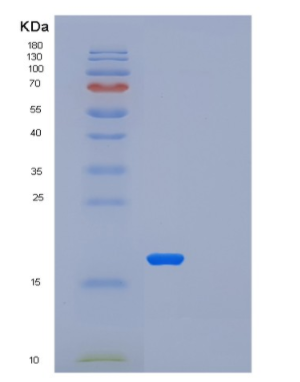 Recombinant Human LSM1 Protein