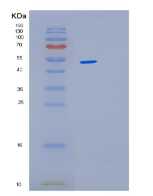 Recombinant Human LPCAT1 Protein