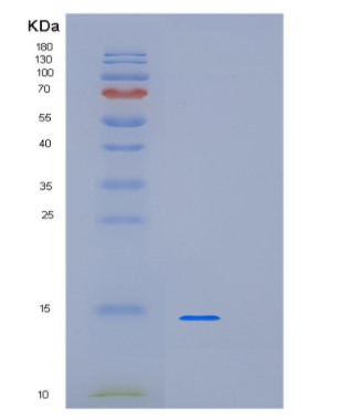 Recombinant Human LSM3 Protein