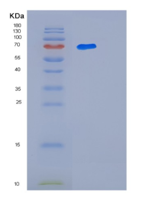 Recombinant Human LTA4H Protein