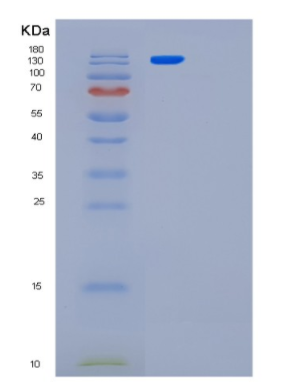 Recombinant LRS (Leucyl-tRNA synthetase) Protein