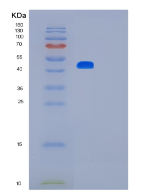 Recombinant Human LMX1B Protein