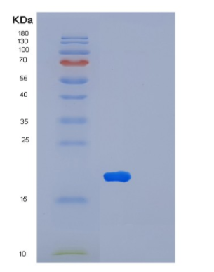 Recombinant Human LTA Protein