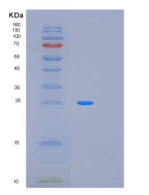 Recombinant Human MAD2L1 Protein
