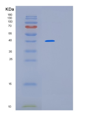 Recombinant Human LRPAP1 Protein