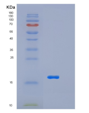 Recombinant Human LSM4 Protein