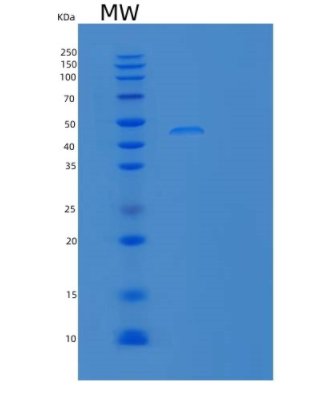 Recombinant Human LY9 Protein