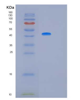 Recombinant Human MAPK11 Protein