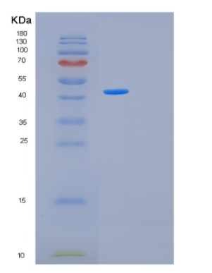 Recombinant Human MAPK12 Protein