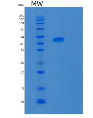 Recombinant Human MAPK9 Protein