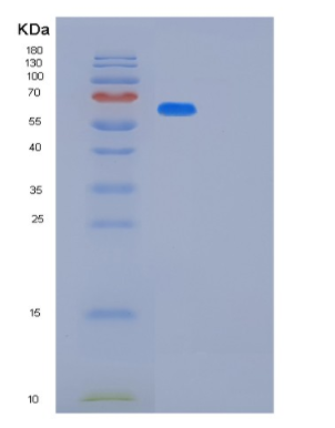 Recombinant Human MAVS Protein