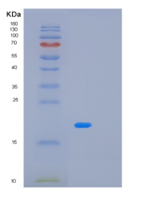 Recombinant Human MBL2 Protein