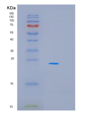 Recombinant Human MBP Protein