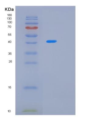 Recombinant E.coli MBP Protein