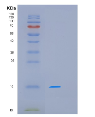 Recombinant Human MCFD2 Protein