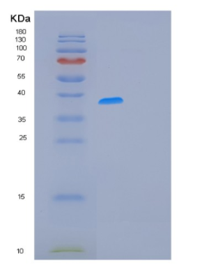 Recombinant Human MCL1 Protein
