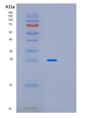Recombinant Human MED20 Protein