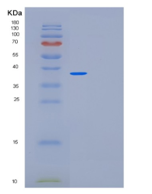 Recombinant Human MED27 Protein