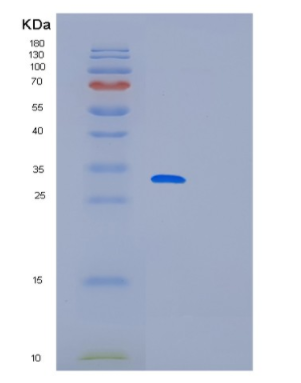 Recombinant Human MED7 Protein