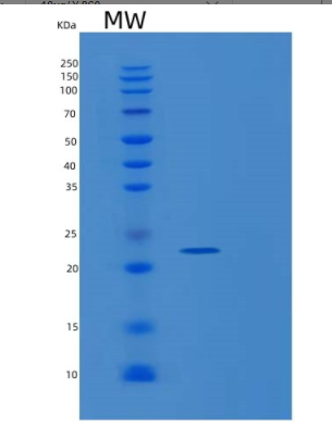 Recombinant Rat Metalloproteinase inhibitor 1 Protein