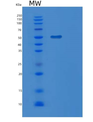 Recombinant Human MGAT2 Protein