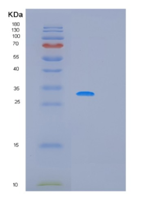 Recombinant Human MFAP4 Protein