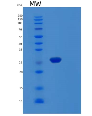 Recombinant Human MOB3B Protein