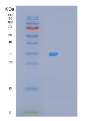 Recombinant Human MPST Protein