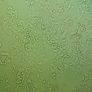 ACC-2人涎腺样囊性癌细胞