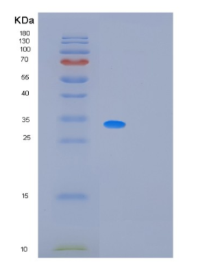 Recombinant Human MRPL1 Protein